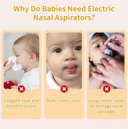 Prémium Elektromos Orrszívó Babáknak – 9 Fokozat, Éjszakai Fény és Nyugtató Zene – USB-s, Hordozható